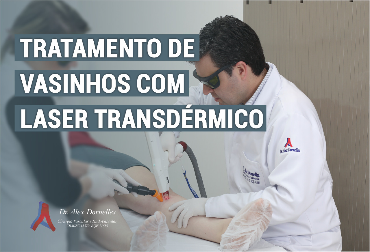 TRATAMENTO DE VASINHOS LASER TRANSDÉRMICO Blog Dr Alex